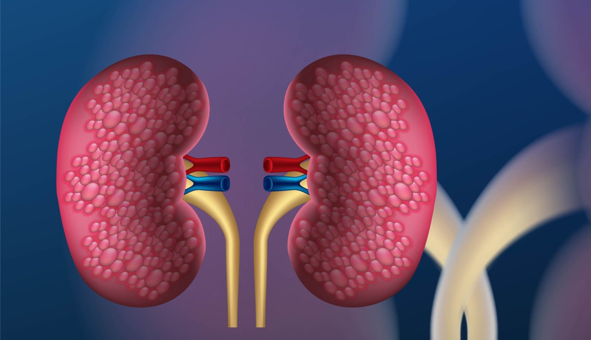 Bubrežni kamenci: uzroci, simptomi, liječenje i prevencija – Kompletan vodič